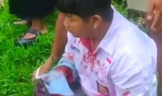 Pelajar SMA di Binjai Jadi Korban Begal Saat Berangkat Sekolah